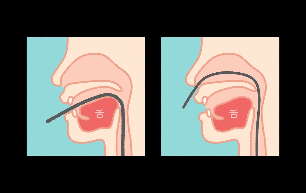 鼻からの胃カメラ検査に対応しています